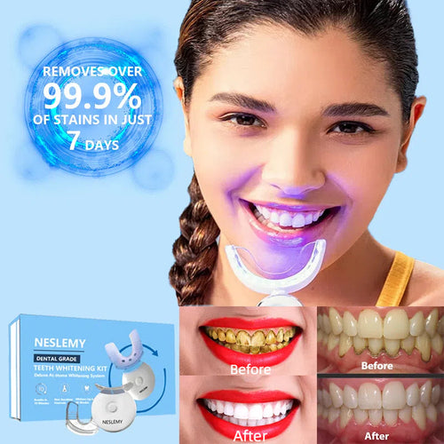 🔥(Official Mall) NESLEMY Original Teeth Whitening Kit with 5x LED Light, 18% Carbamide Peroxide Oral Care