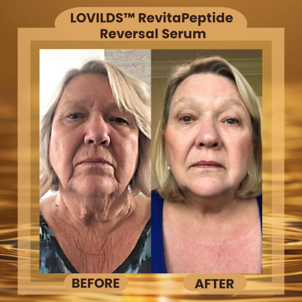 ❄️New Year Special 50% Off☃️ LOVILDS™ RevitaPeptide Reversal Serum