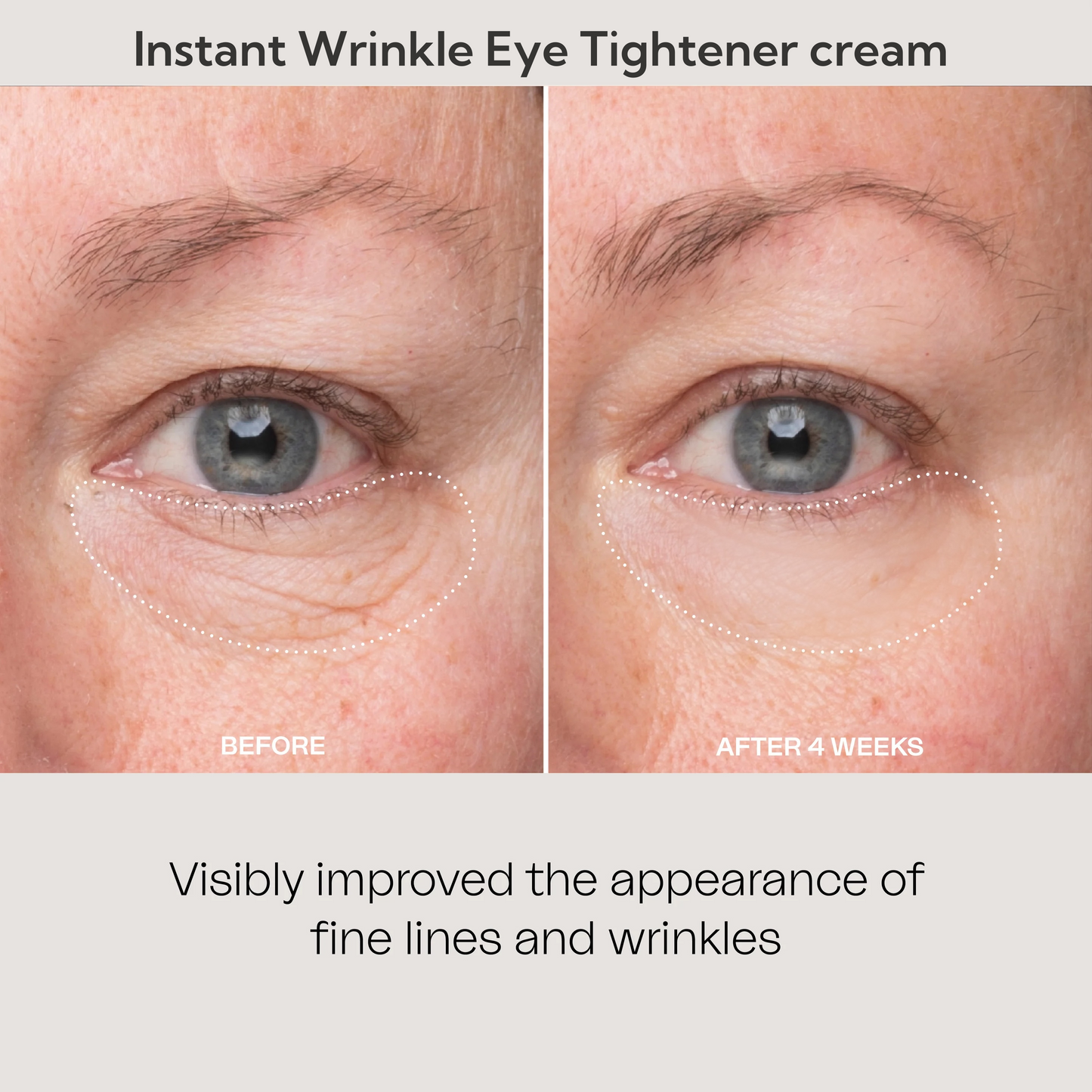 ✨New Year Special 50% Off ☃️ Instant Wrinkle Eye Tightener Cream