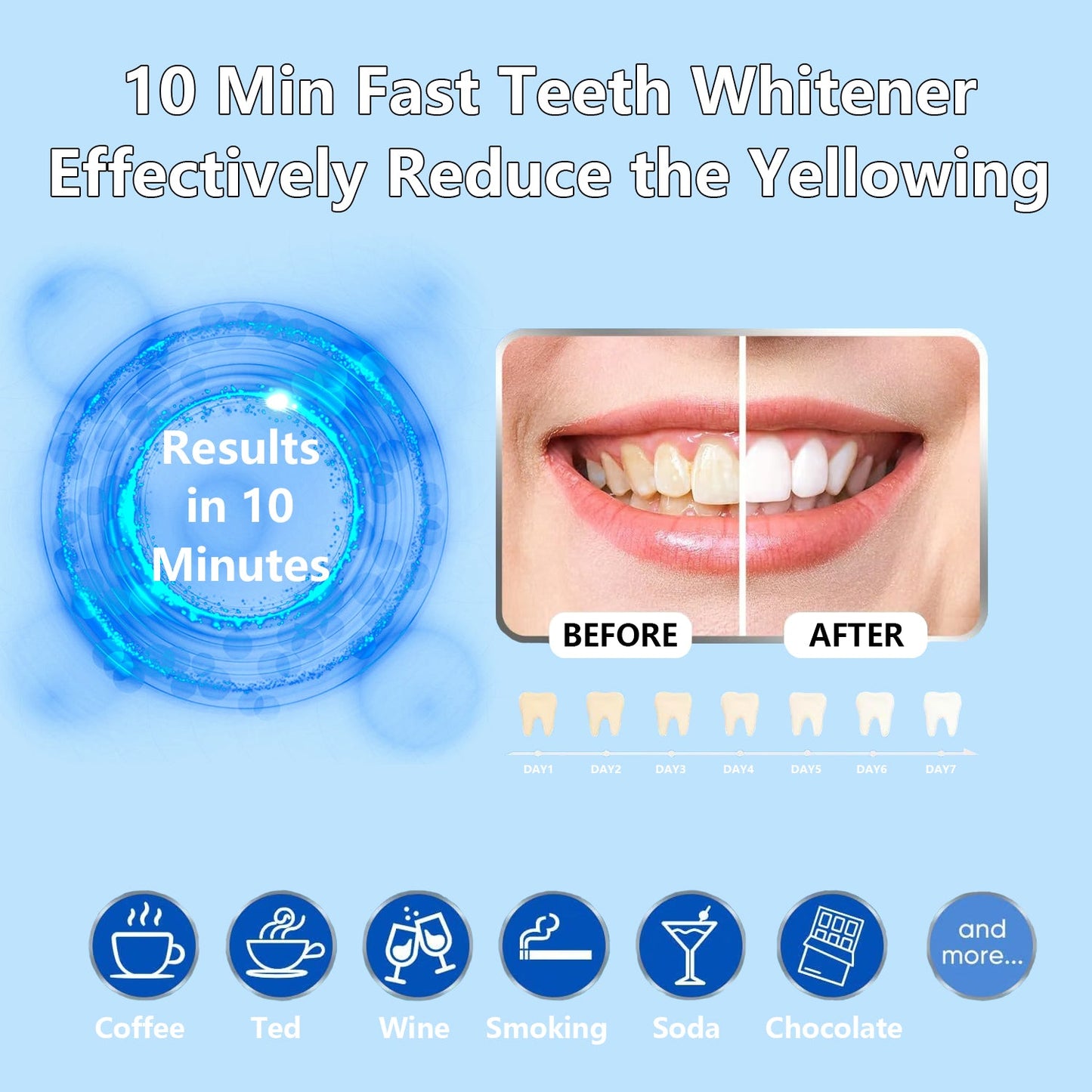 🔥(Official Mall) NESLEMY Original Teeth Whitening Kit with 5x LED Light, 18% Carbamide Peroxide Oral Care